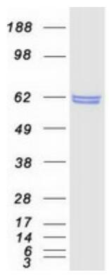 Coomassie blue staining of purified IRF6 protein.